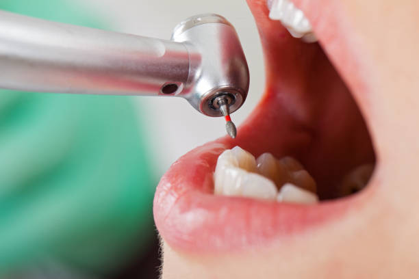 Best Emergency Dental Care for Trauma or Injury in Robins Af, GA